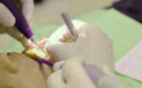 我的拔牙經(jīng)歷作文(通用26篇)