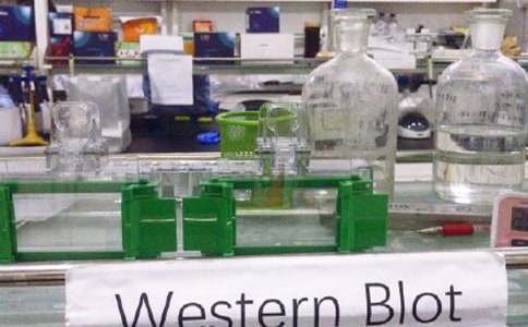 �z򞼼����ԇ�R��ѪҺ�W:HA�l(f��)���C���c����ҙz��